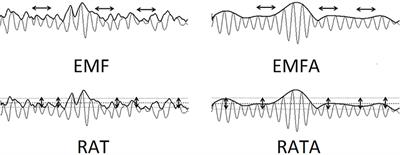 Lack of a Sense of Threat and Higher Emotional Lability in Patients With Chronic Microvascular Ischemia as Measured by Non-linear EEG Parameters